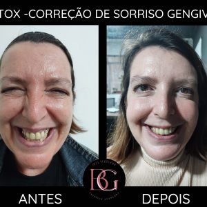 parceiro
